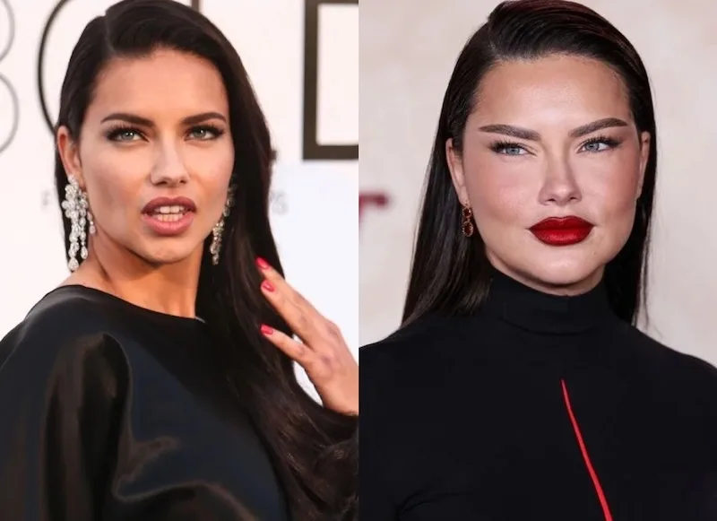 24 случая, когда бьюти-процедуры изменили знаменитостей к лучшему или худшему0