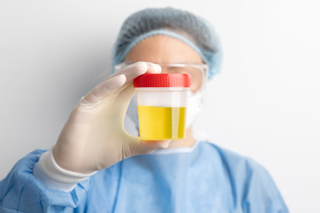 lab-doctor-performing-medical-exam-urine lab-doctor-performing-medical-exam-urine0