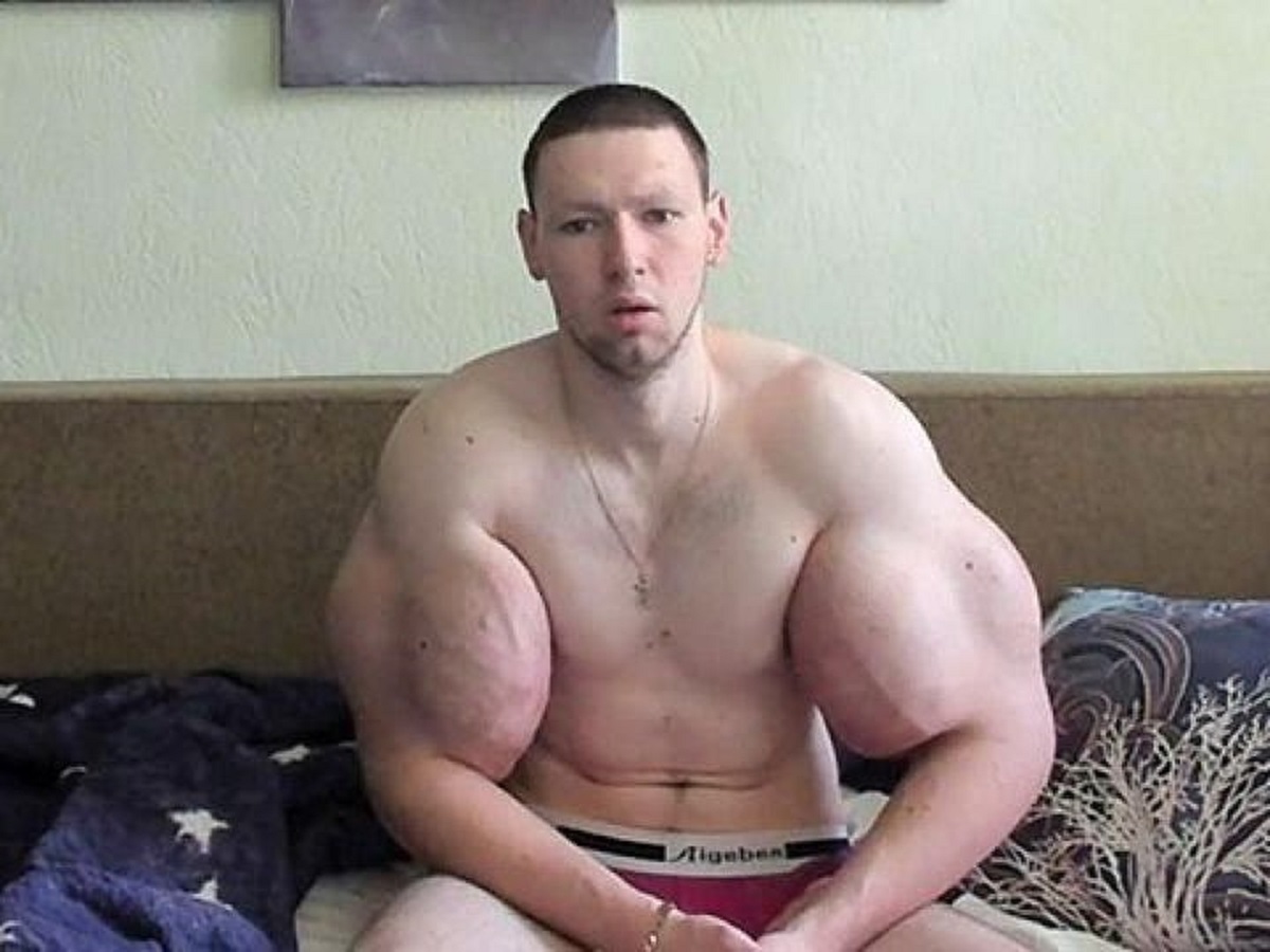 У блогера Руки-Базуки начали гнить руки: шокирующие фото вызвали обсуждение в сети0