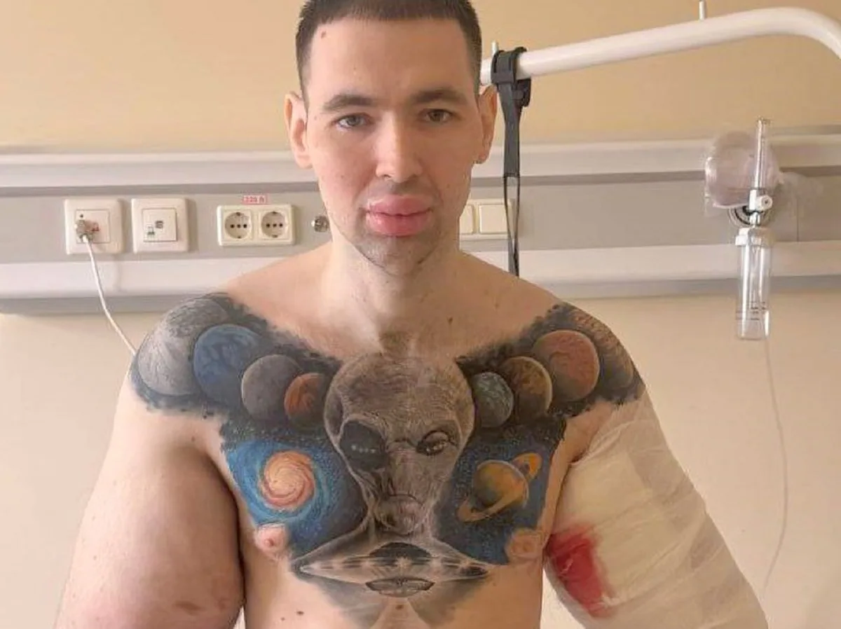 СМИ: блогера Руки-Базуки может ждать ампутация рук и ног0