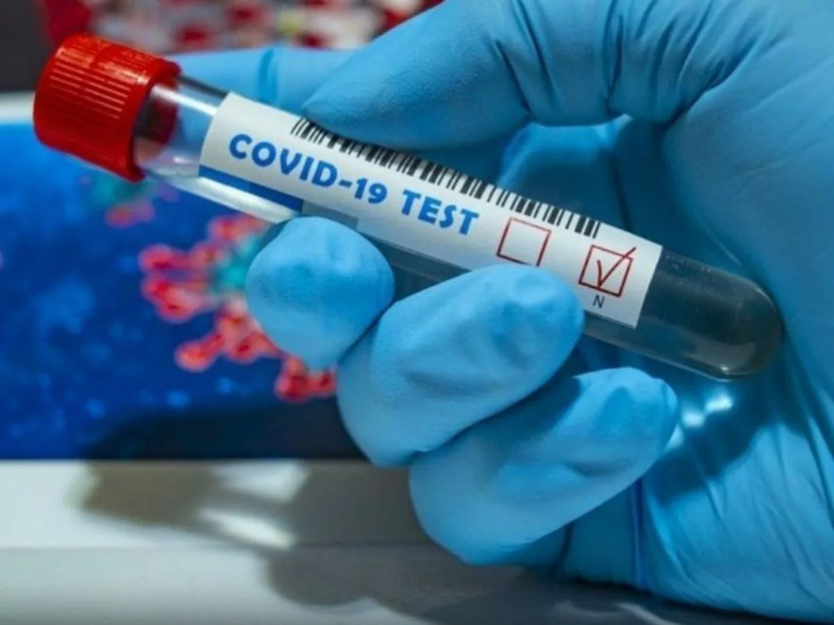 В России зафиксирован самый длительный случай заражения коронавирусом0